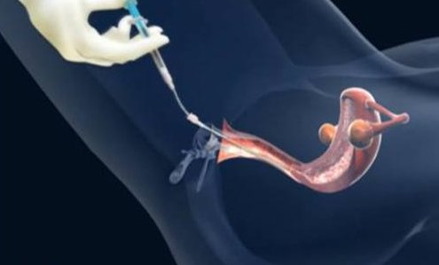 快看2026年最新北京大学人民医院三代试管费用总共多少？