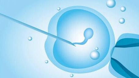 试管婴儿备孕检查的内容哪些？试管婴儿备孕前的检查事项，试管婴儿检查项目孩子生的区别